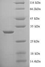 SDS-PAGE- Recombinant protein Mycobacterium inhA