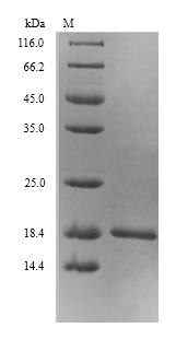 (Tris-Glycine gel) Discontinuous SDS-PAGE (reduced) with 5% enrichment gel and 15% separation gel. (Tris-Glycine gel) Discontinuous SDS-PAGE (reduced) with 5% enrichment gel and 15% separation gel.