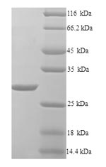 (Tris-Glycine gel) Discontinuous SDS-PAGE (reduced) with 5% enrichment gel and 15% separation gel.