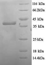 (Tris-Glycine gel) Discontinuous SDS-PAGE (reduced) with 5% enrichment gel and 15% separation gel. (Tris-Glycine gel) Discontinuous SDS-PAGE (reduced) with 5% enrichment gel and 15% separation gel.