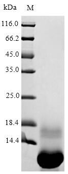 (Tris-Glycine gel) Discontinuous SDS-PAGE (reduced) with 5% enrichment gel and 15% separation gel. (Tris-Glycine gel) Discontinuous SDS-PAGE (reduced) with 5% enrichment gel and 15% separation gel.