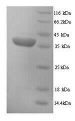 (Tris-Glycine gel) Discontinuous SDS-PAGE (reduced) with 5% enrichment gel and 15% separation gel. (Tris-Glycine gel) Discontinuous SDS-PAGE (reduced) with 5% enrichment gel and 15% separation gel.