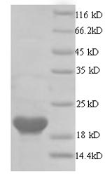 (Tris-Glycine gel) Discontinuous SDS-PAGE (reduced) with 5% enrichment gel and 15% separation gel. (Tris-Glycine gel) Discontinuous SDS-PAGE (reduced) with 5% enrichment gel and 15% separation gel.