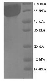 (Tris-Glycine gel) Discontinuous SDS-PAGE (reduced) with 5% enrichment gel and 15% separation gel. (Tris-Glycine gel) Discontinuous SDS-PAGE (reduced) with 5% enrichment gel and 15% separation gel.