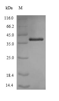 (Tris-Glycine gel) Discontinuous SDS-PAGE (reduced) with 5% enrichment gel and 15% separation gel. (Tris-Glycine gel) Discontinuous SDS-PAGE (reduced) with 5% enrichment gel and 15% separation gel.