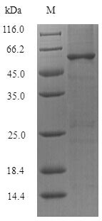 SDS-PAGE- Recombinant protein Lactobacillus groL