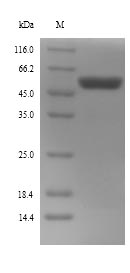 (Tris-Glycine gel) Discontinuous SDS-PAGE (reduced) with 5% enrichment gel and 15% separation gel. (Tris-Glycine gel) Discontinuous SDS-PAGE (reduced) with 5% enrichment gel and 15% separation gel.