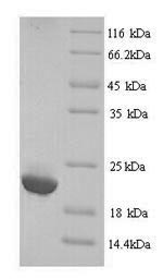 SDS-PAGE- Recombinant protein Human IGLL5