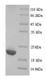 (Tris-Glycine gel) Discontinuous SDS-PAGE (reduced) with 5% enrichment gel and 15% separation gel. (Tris-Glycine gel) Discontinuous SDS-PAGE (reduced) with 5% enrichment gel and 15% separation gel.