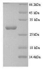SDS-PAGE- Recombinant protein Streptomyces nosM