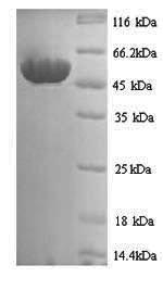 (Tris-Glycine gel) Discontinuous SDS-PAGE (reduced) with 5% enrichment gel and 15% separation gel. (Tris-Glycine gel) Discontinuous SDS-PAGE (reduced) with 5% enrichment gel and 15% separation gel.
