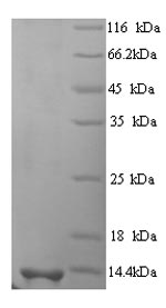 (Tris-Glycine gel) Discontinuous SDS-PAGE (reduced) with 5% enrichment gel and 15% separation gel. (Tris-Glycine gel) Discontinuous SDS-PAGE (reduced) with 5% enrichment gel and 15% separation gel.