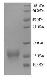 (Tris-Glycine gel) Discontinuous SDS-PAGE (reduced) with 5% enrichment gel and 15% separation gel. (Tris-Glycine gel) Discontinuous SDS-PAGE (reduced) with 5% enrichment gel and 15% separation gel.