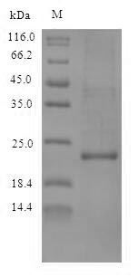(Tris-Glycine gel) Discontinuous SDS-PAGE (reduced) with 5% enrichment gel and 15% separation gel. (Tris-Glycine gel) Discontinuous SDS-PAGE (reduced) with 5% enrichment gel and 15% separation gel.