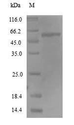 (Tris-Glycine gel) Discontinuous SDS-PAGE (reduced) with 5% enrichment gel and 15% separation gel. (Tris-Glycine gel) Discontinuous SDS-PAGE (reduced) with 5% enrichment gel and 15% separation gel.