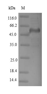(Tris-Glycine gel) Discontinuous SDS-PAGE (reduced) with 5% enrichment gel and 15% separation gel. (Tris-Glycine gel) Discontinuous SDS-PAGE (reduced) with 5% enrichment gel and 15% separation gel.