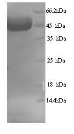 (Tris-Glycine gel) Discontinuous SDS-PAGE (reduced) with 5% enrichment gel and 15% separation gel. (Tris-Glycine gel) Discontinuous SDS-PAGE (reduced) with 5% enrichment gel and 15% separation gel.