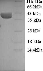 (Tris-Glycine gel) Discontinuous SDS-PAGE (reduced) with 5% enrichment gel and 15% separation gel. (Tris-Glycine gel) Discontinuous SDS-PAGE (reduced) with 5% enrichment gel and 15% separation gel.
