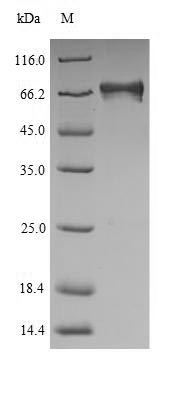 (Tris-Glycine gel) Discontinuous SDS-PAGE (reduced) with 5% enrichment gel and 15% separation gel. (Tris-Glycine gel) Discontinuous SDS-PAGE (reduced) with 5% enrichment gel and 15% separation gel.