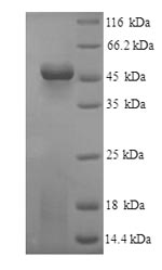 (Tris-Glycine gel) Discontinuous SDS-PAGE (reduced) with 5% enrichment gel and 15% separation gel. (Tris-Glycine gel) Discontinuous SDS-PAGE (reduced) with 5% enrichment gel and 15% separation gel.