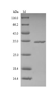 (Tris-Glycine gel) Discontinuous SDS-PAGE (reduced) with 5% enrichment gel and 15% separation gel. (Tris-Glycine gel) Discontinuous SDS-PAGE (reduced) with 5% enrichment gel and 15% separation gel.