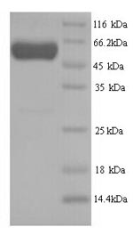 (Tris-Glycine gel) Discontinuous SDS-PAGE (reduced) with 5% enrichment gel and 15% separation gel. (Tris-Glycine gel) Discontinuous SDS-PAGE (reduced) with 5% enrichment gel and 15% separation gel.