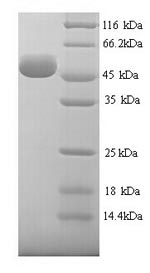 (Tris-Glycine gel) Discontinuous SDS-PAGE (reduced) with 5% enrichment gel and 15% separation gel. (Tris-Glycine gel) Discontinuous SDS-PAGE (reduced) with 5% enrichment gel and 15% separation gel.