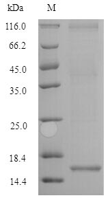 (Tris-Glycine gel) Discontinuous SDS-PAGE (reduced) with 5% enrichment gel and 15% separation gel. (Tris-Glycine gel) Discontinuous SDS-PAGE (reduced) with 5% enrichment gel and 15% separation gel.