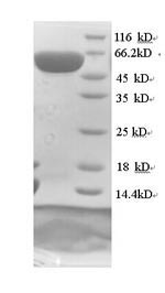 (Tris-Glycine gel) Discontinuous SDS-PAGE (reduced) with 5% enrichment gel and 15% separation gel. (Tris-Glycine gel) Discontinuous SDS-PAGE (reduced) with 5% enrichment gel and 15% separation gel.