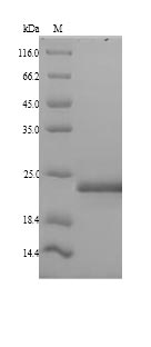 (Tris-Glycine gel) Discontinuous SDS-PAGE (reduced) with 5% enrichment gel and 15% separation gel. (Tris-Glycine gel) Discontinuous SDS-PAGE (reduced) with 5% enrichment gel and 15% separation gel.