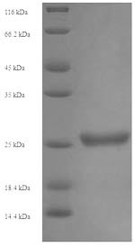 (Tris-Glycine gel) Discontinuous SDS-PAGE (reduced) with 5% enrichment gel and 15% separation gel. (Tris-Glycine gel) Discontinuous SDS-PAGE (reduced) with 5% enrichment gel and 15% separation gel.