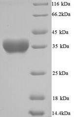 (Tris-Glycine gel) Discontinuous SDS-PAGE (reduced) with 5% enrichment gel and 15% separation gel. (Tris-Glycine gel) Discontinuous SDS-PAGE (reduced) with 5% enrichment gel and 15% separation gel.