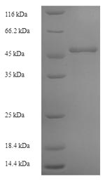 (Tris-Glycine gel) Discontinuous SDS-PAGE (reduced) with 5% enrichment gel and 15% separation gel. (Tris-Glycine gel) Discontinuous SDS-PAGE (reduced) with 5% enrichment gel and 15% separation gel.