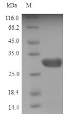 (Tris-Glycine gel) Discontinuous SDS-PAGE (reduced) with 5% enrichment gel and 15% separation gel. (Tris-Glycine gel) Discontinuous SDS-PAGE (reduced) with 5% enrichment gel and 15% separation gel.