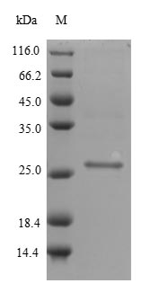 (Tris-Glycine gel) Discontinuous SDS-PAGE (reduced) with 5% enrichment gel and 15% separation gel. (Tris-Glycine gel) Discontinuous SDS-PAGE (reduced) with 5% enrichment gel and 15% separation gel.