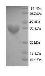 SDS-PAGE- Recombinant protein Staphylococcus fabD