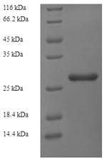 (Tris-Glycine gel) Discontinuous SDS-PAGE (reduced) with 5% enrichment gel and 15% separation gel. (Tris-Glycine gel) Discontinuous SDS-PAGE (reduced) with 5% enrichment gel and 15% separation gel.