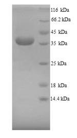 (Tris-Glycine gel) Discontinuous SDS-PAGE (reduced) with 5% enrichment gel and 15% separation gel. (Tris-Glycine gel) Discontinuous SDS-PAGE (reduced) with 5% enrichment gel and 15% separation gel.