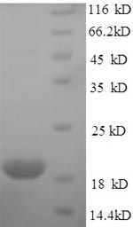(Tris-Glycine gel) Discontinuous SDS-PAGE (reduced) with 5% enrichment gel and 15% separation gel. (Tris-Glycine gel) Discontinuous SDS-PAGE (reduced) with 5% enrichment gel and 15% separation gel.
