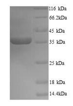 (Tris-Glycine gel) Discontinuous SDS-PAGE (reduced) with 5% enrichment gel and 15% separation gel. (Tris-Glycine gel) Discontinuous SDS-PAGE (reduced) with 5% enrichment gel and 15% separation gel.