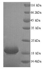 (Tris-Glycine gel) Discontinuous SDS-PAGE (reduced) with 5% enrichment gel and 15% separation gel. (Tris-Glycine gel) Discontinuous SDS-PAGE (reduced) with 5% enrichment gel and 15% separation gel.
