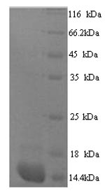 (Tris-Glycine gel) Discontinuous SDS-PAGE (reduced) with 5% enrichment gel and 15% separation gel. (Tris-Glycine gel) Discontinuous SDS-PAGE (reduced) with 5% enrichment gel and 15% separation gel.