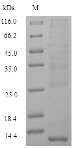 (Tris-Glycine gel) Discontinuous SDS-PAGE (reduced) with 5% enrichment gel and 15% separation gel. (Tris-Glycine gel) Discontinuous SDS-PAGE (reduced) with 5% enrichment gel and 15% separation gel.