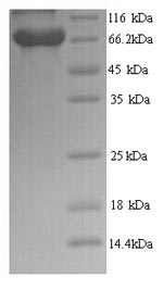 SDS-PAGE- Recombinant protein Human BRAP