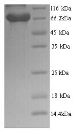 (Tris-Glycine gel) Discontinuous SDS-PAGE (reduced) with 5% enrichment gel and 15% separation gel. (Tris-Glycine gel) Discontinuous SDS-PAGE (reduced) with 5% enrichment gel and 15% separation gel.