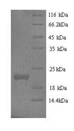 (Tris-Glycine gel) Discontinuous SDS-PAGE (reduced) with 5% enrichment gel and 15% separation gel. (Tris-Glycine gel) Discontinuous SDS-PAGE (reduced) with 5% enrichment gel and 15% separation gel.