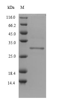 (Tris-Glycine gel) Discontinuous SDS-PAGE (reduced) with 5% enrichment gel and 15% separation gel. (Tris-Glycine gel) Discontinuous SDS-PAGE (reduced) with 5% enrichment gel and 15% separation gel.