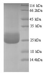 (Tris-Glycine gel) Discontinuous SDS-PAGE (reduced) with 5% enrichment gel and 15% separation gel. (Tris-Glycine gel) Discontinuous SDS-PAGE (reduced) with 5% enrichment gel and 15% separation gel.