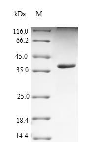 (Tris-Glycine gel) Discontinuous SDS-PAGE (reduced) with 5% enrichment gel and 15% separation gel. (Tris-Glycine gel) Discontinuous SDS-PAGE (reduced) with 5% enrichment gel and 15% separation gel.