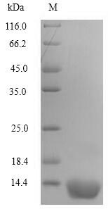(Tris-Glycine gel) Discontinuous SDS-PAGE (reduced) with 5% enrichment gel and 15% separation gel. (Tris-Glycine gel) Discontinuous SDS-PAGE (reduced) with 5% enrichment gel and 15% separation gel.